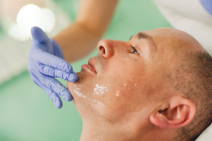 facial treatments for men, Camberley aesthetics clinic