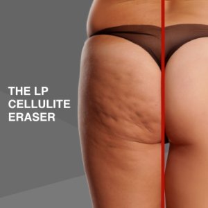 Cellulite Treatments Camberley Surrey